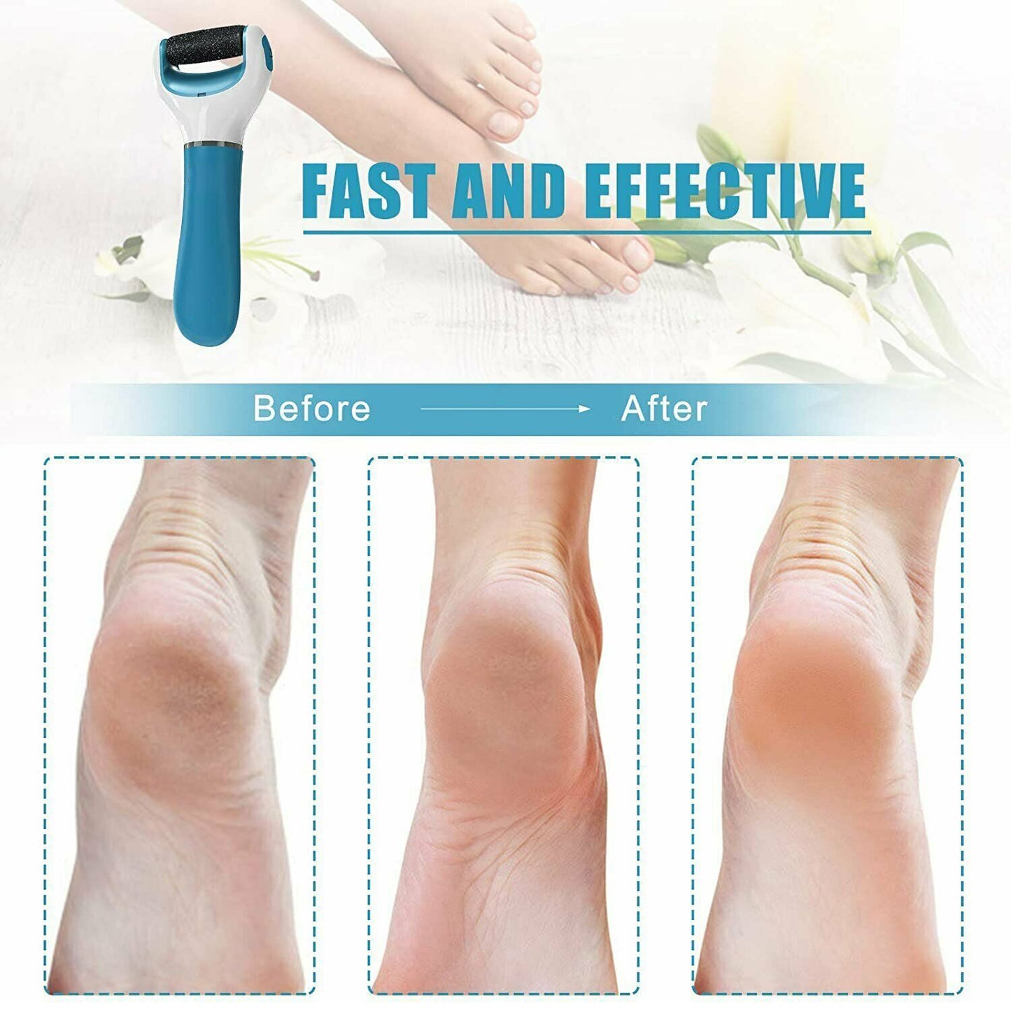 0229 Electronic Dry Foot File Callous Remover For Feet Electric Foot With Roller Hard And Dead Skin- Regular Coarse Baby Smooth Feet In Minutes. For In Home Padicure Foot Care Battery Powered Usb (Battry Not Included)
